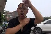 تردد ترسناک مار از بینی این مرد به دهانش!+فیلم