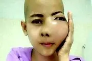 رشد تومور زشت روی صورت این دختر زیبا!+عکس