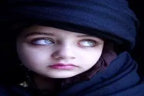 صاحب زیباترین چشم‌های جهان + عکس