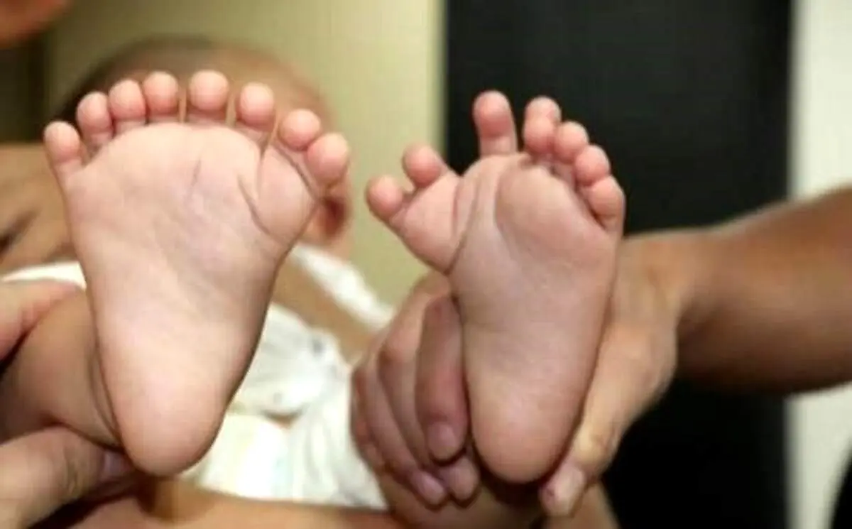 تولد نوزاد عجب الخلقه با 31 انگشت+ عکس