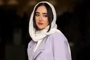 تغییر چهره شیطانِ «او یک فرشته بود» با تزریق های زیبایی!/ عکس