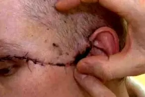 متلاشی شدن صورت این زن با مته برقی! + عکس