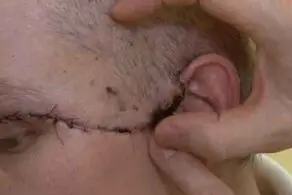 متلاشی شدن صورت این زن با مته برقی! + عکس