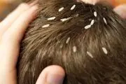 از موهای این دختر بیچاره شپش می‌چکد! +عکس