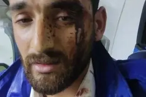 آماده‌باش کامل نیروهای عملیاتی اورژانس استان تهران