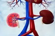بدترین و آسیب زننده ترین مواد غذایی برای کلیه ها

