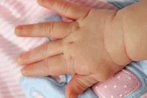 تولدی ترسناک، این زن کودکی با سر و بدن قورباغه به دنیا آورد/ عکس