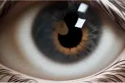 چشم های از کاسه درآمده این زن همه را وحشت زده می کند+ عکس