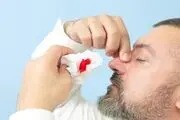 این گیاهان برای خون دماغ مفید است