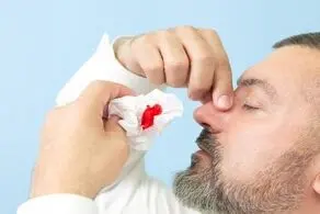 این گیاهان برای خون دماغ مفید است