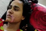 پدرشوهر پست فطرت دهان عروسش را سوزاند!+عکس