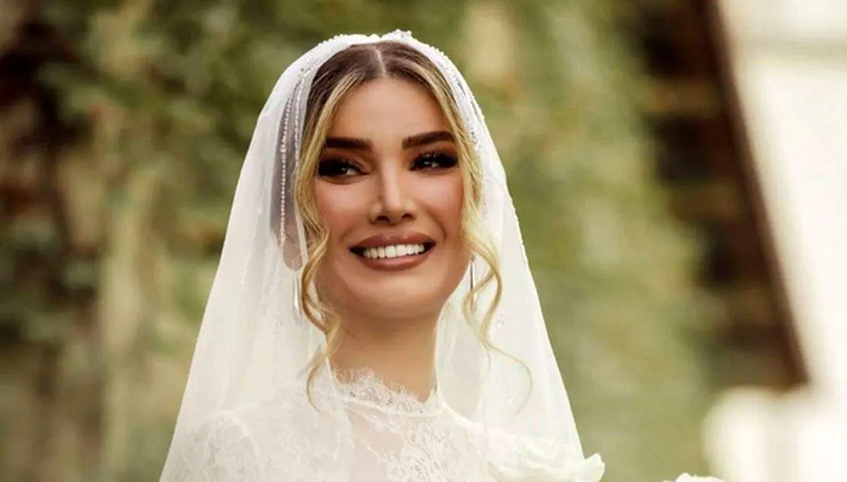 متین ستوده بعد از ماه عسل تغییر چهره داد!/ تصاویر