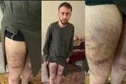 شکنجه یک خبرنگار توسط طالبان + عکس
