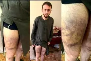 شکنجه یک خبرنگار توسط طالبان + عکس