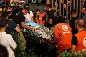 تصویری از جراحت کودک مظلوم لبنانی بر اثر انفجار پیجر + ببینید 