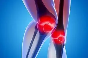 افزایش مبتلایان به یک عارضه دردناک تا سال ۲۰۵۰