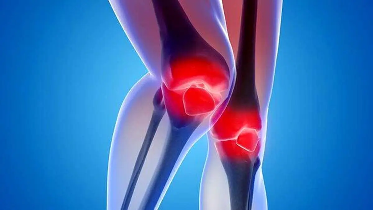 افزایش مبتلایان به یک عارضه دردناک تا سال ۲۰۵۰