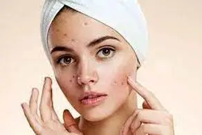 رفع چین و چروک صورت در خانه در ۲ دقیقه!