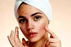 رفع چین و چروک صورت در خانه در ۲ دقیقه!