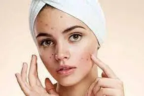 رفع چین و چروک صورت در خانه در ۲ دقیقه!