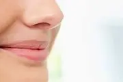 زن بدبختی که رشد بینی اش تمامی ندارد/ عکس