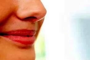 از دیدن بینی این مرد روی سرش شوکه می شوید+ عکس