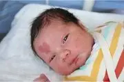 تولد یک نوزاد عجیب با یک خال ماورایی بر پیشانی‌اش+عکس