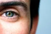 بیماری‌هایی که می‌توانید از روی چشم ها تشخیص دهید
