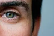 بیماری‌هایی که می‌توانید از روی چشم ها تشخیص دهید
