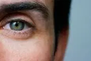 بیماری‌هایی که می‌توانید از روی چشم ها تشخیص دهید
