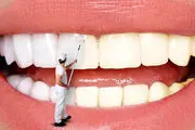 ۵ ترفند خانگی برای خداحافظی با زردی دندان