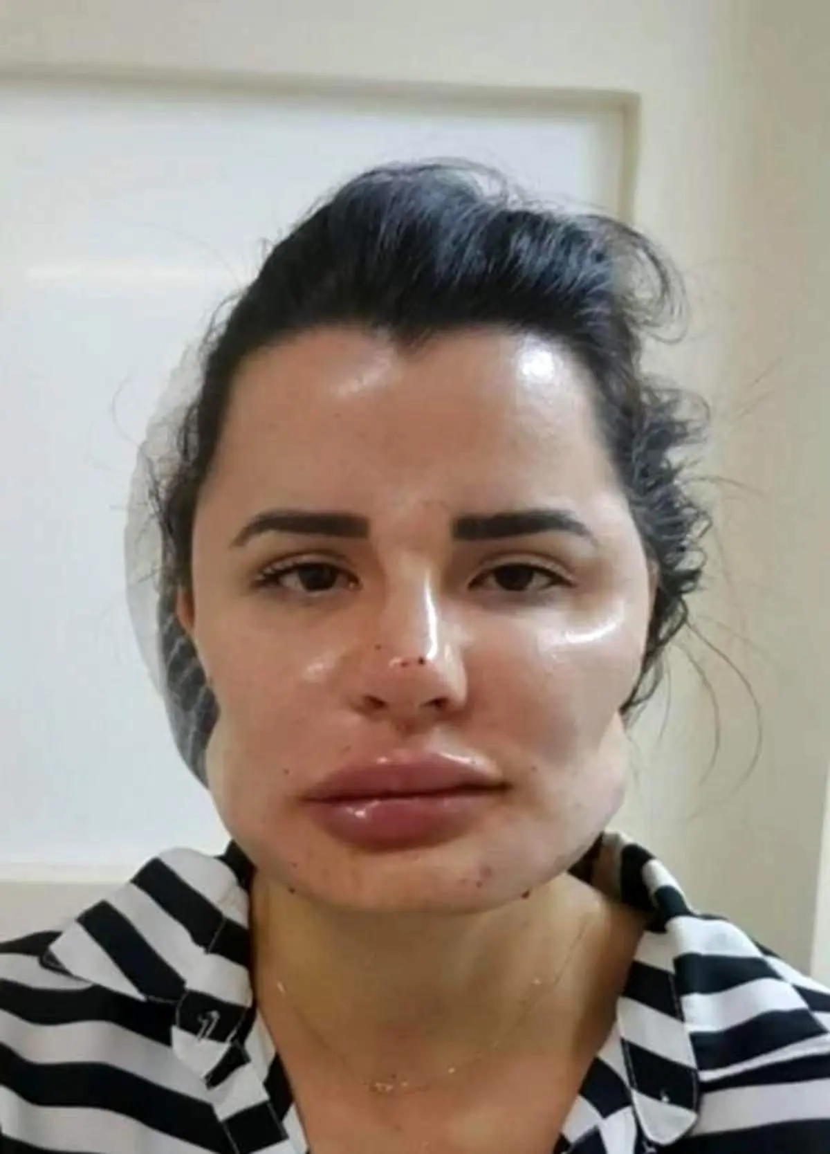 ماجرای پزشکی که بیمارانش را تبدیل به دراکولا میکند!+عکسهای ترسناک
