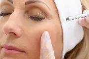 آنچه که در خصوص بوتاکس نمی‌دانید