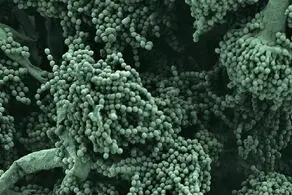 حقایقی باورنکردنی درمورد عفونت‌های قارچی
