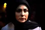 نیوشا ضیغمی عمل زیبایی کرد/ عکس