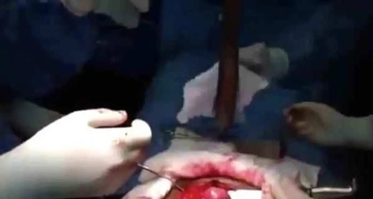 بیرون آوردن ماهی زنده از شکم این مرد بخت برگشته +عکس