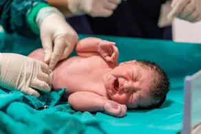 یک نوزاد پیر به دنیا آمد+ عکس