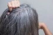 راهکاری برای جلوگیری از سفیدی مو وجود دارد؟