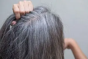راهکاری برای جلوگیری از سفیدی مو وجود دارد؟