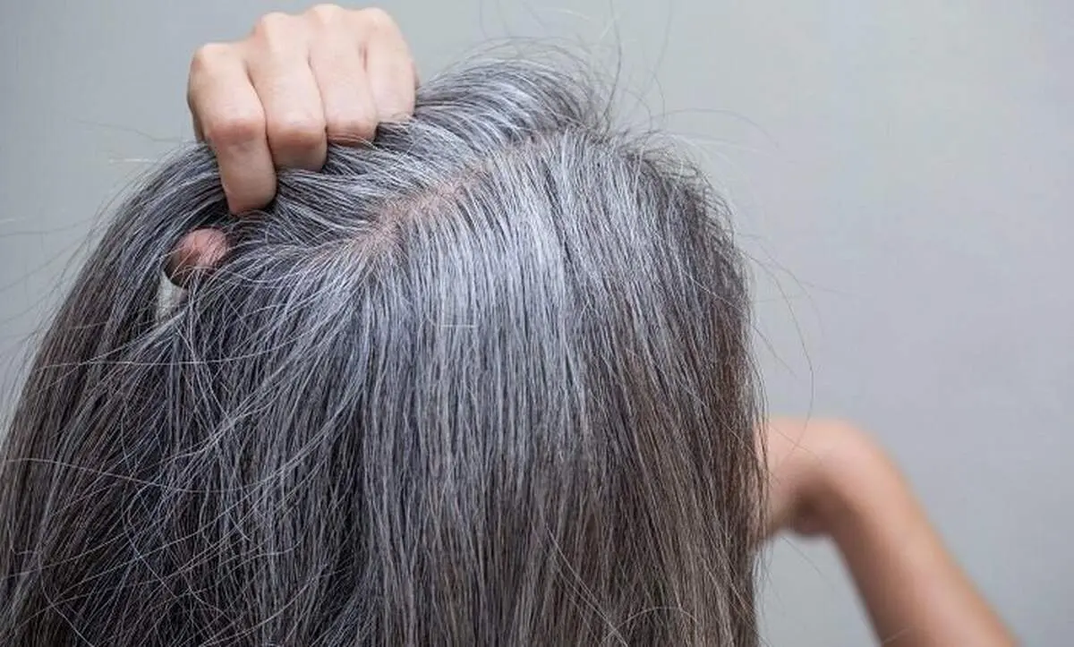 راهکاری برای جلوگیری از سفیدی مو وجود دارد؟