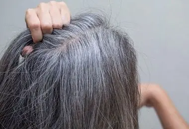 راهکاری برای جلوگیری از سفیدی مو وجود دارد؟