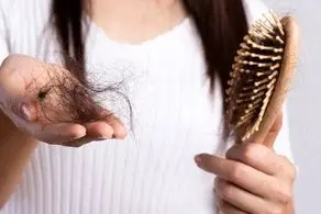 چرا کرونا موجب ریزش مو می‌شود+ روش‌های درمان