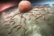  ۵۰ نوع سرطان با یک آزمایش خون قابل تشخیص است
