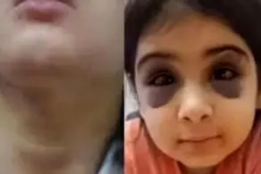 کتک و آزار وحشتناک دختر بچه  ۹ ساله در سنندج/ پدر همسر باردار را از خانه بیرون کرد،+عکس و جزئیات