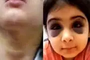 کتک و آزار وحشتناک دختر بچه  ۹ ساله در سنندج/ پدر همسر باردار را از خانه بیرون کرد،+عکس و جزئیات