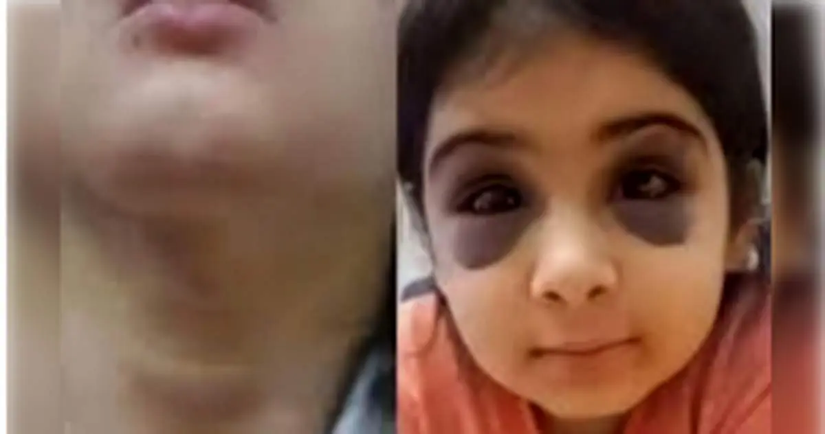 کتک و آزار وحشتناک دختر بچه  ۹ ساله در سنندج/ پدر همسر باردار را از خانه بیرون کرد،+عکس و جزئیات