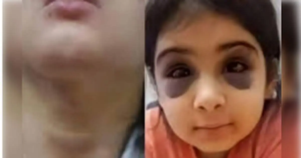 کتک و آزار وحشتناک دختر بچه  ۹ ساله در سنندج/ پدر همسر باردار را از خانه بیرون کرد،+عکس و جزئیات