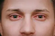 چه کنیم تا به «قارچ سیاه» مبتلا نشویم؟