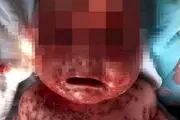 بلای که مادر با بوسیدن بر سر نوزادش آورد! + عکس