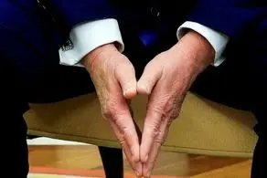 کبودی دست ترامپ خبرساز شد + ببینید 